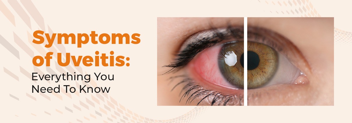 Symptoms of Uveitis